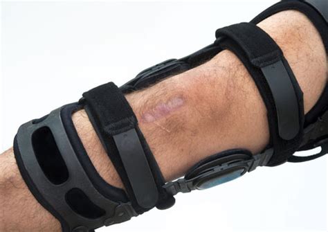 MCL Sprain Recovery Time - Injury Health Blog