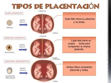 Embarazos Múltiples