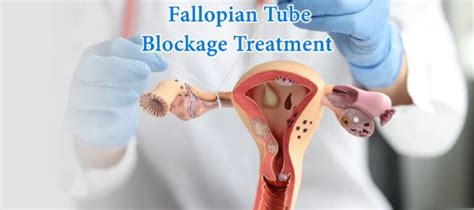 Treatment for Blocked Fallopian Tubes, Symptoms and Fertility