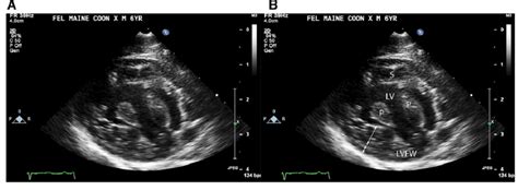 Two Dimensional Echocardiograms Of The Heart A Right Parasternal