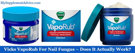 Vicks VapoRub For Nail Fungus – Does It Actually Work? - Supplementox