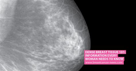 Dense Breast Tissue 101 Information Every Woman Needs To Know Breast