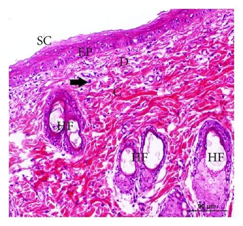 Histological Sections From The Wound Area Stained With Download