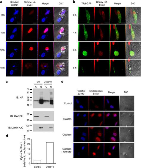 Siva1 Is Predominantly Nuclear But Translocates To The Cytoplasm Upon