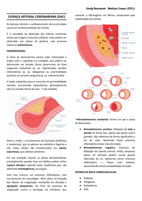 Doen As Coronarianas Doen A Arterial Coronariana Dac As Doen As