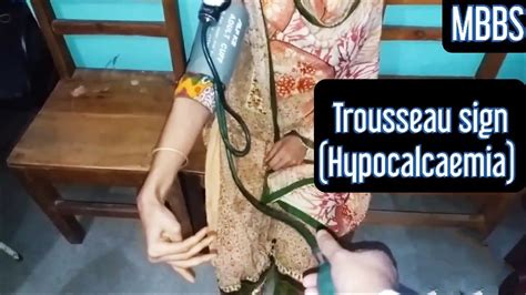 Trousseau Sign Seen In Hypocalcaemia Mbbs Medicine Neet Neetpg Usmle Next Aiims Youtube