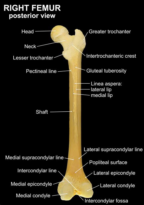 FEMUR – Clinical Anatomy