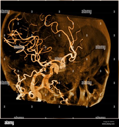 Ct Scan With 3d Reconstruction