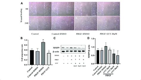 Luteolin Inhibits The Migration Of Rat Pasmcs Induced By Pdgf Bb