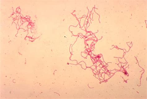 Haemophilus Ducreyi Schokoladenagar