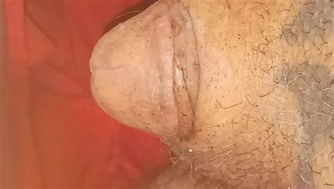 Burning Cock Head Gland With Lighter Gay Porn Xhamster