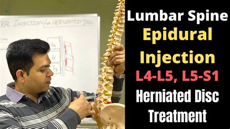 Spinal Injections For Lower Back Pain Epidural Steroid Injection For