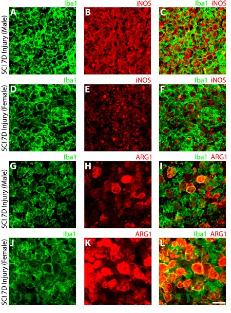 Figure From Sex Dependent Disparities In The Central Innate Immune