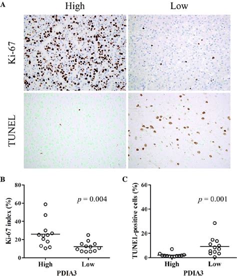 Ki 67 Labeling Index And Tunel Index In Hcc A Representative Download Scientific Diagram