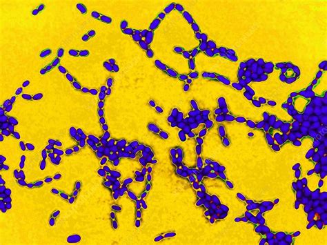 Haemophilus Ducreyi Gram Stain