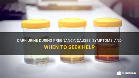 Dark Urine During Pregnancy: Causes, Symptoms, And When To Seek Help ...