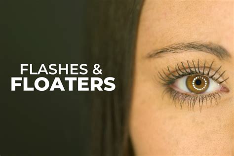 Should You Worry About Eye Flashes And Floaters EZOnTheEyes