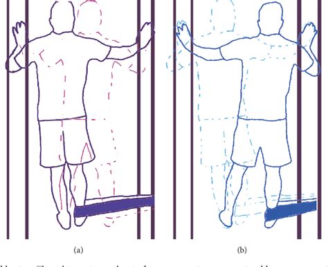 Return To Sport After Criteria Based Rehabilitation Of 47 Off