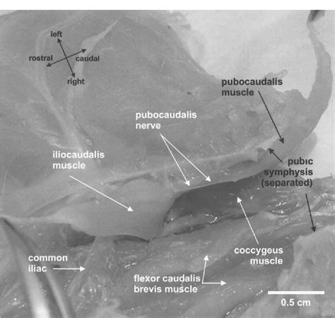 Structure of coccygeal nerve | Semantic Scholar