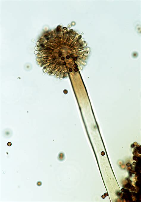 Aspergillus niger | A single conidiophore of the mold Asperg… | Flickr