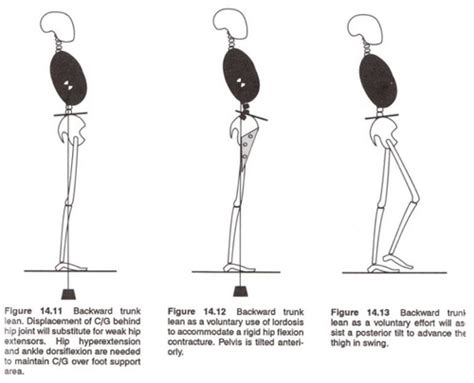 Gait Normal And Abnormal Flashcards Quizlet