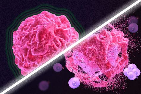 New MIT Cancer Treatment Jump-Starts the Immune System