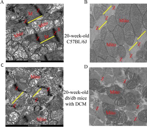 Transmission Electron Microscopy Micrographs Of Myocardial Myofilaments