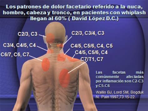 Cervicalgia Causas Sintomas Y Tratamiento Images