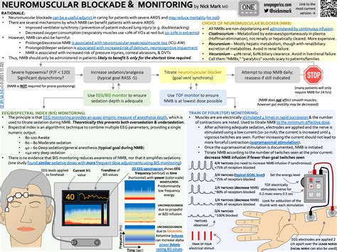 Icu Onepager On Twitter New Icuonepager On How To Use Neuromuscular