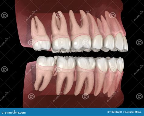 Maxillary And Mandibular