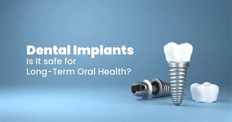 Are Dental Implants Safe For Long Term Oral Health