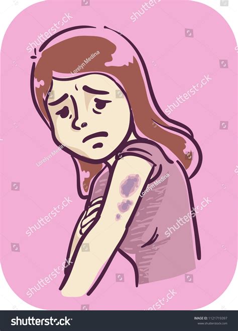 Illustration Girl Bruises On Her Arms Stock Vector Royalty Free