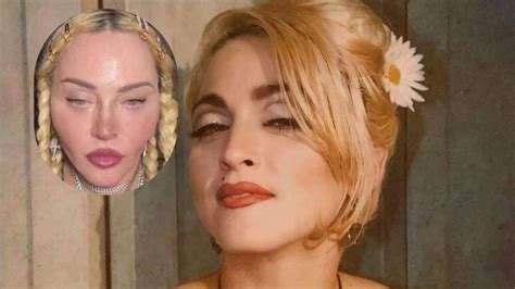 Madonna Preocupa A Seguidores Con Nueva Cara Lavozbolivia