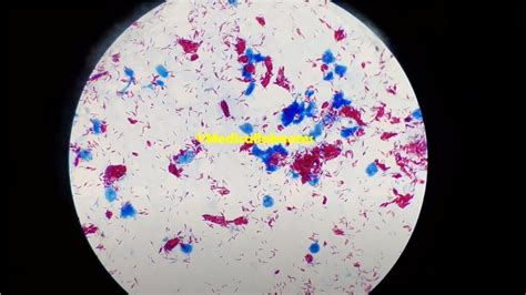 Mycobacterium Leprae Introduction Morphology Pathogen