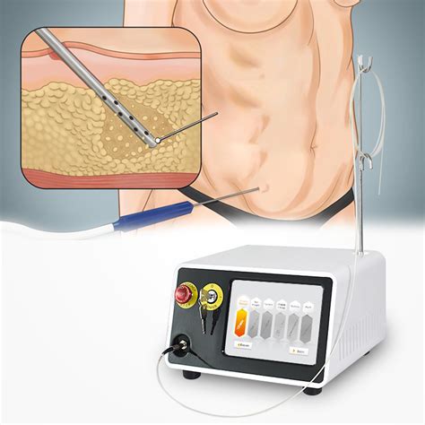 Minimal Invasive Laser Lipolysis 1470 980nm Liposuction Surgical