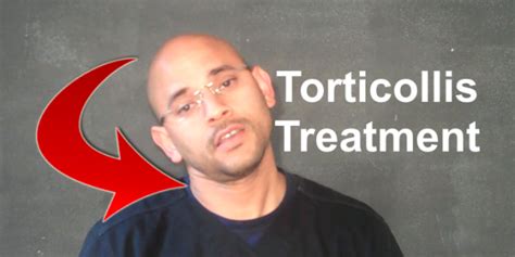 3 Tips for the Treatment of Torticollis | Atlanta Chiropractor ...