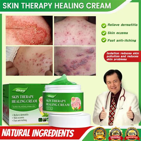 Gamot Sa Kati Kati Sa Balat Skin Fighter Atoderma Cream Original