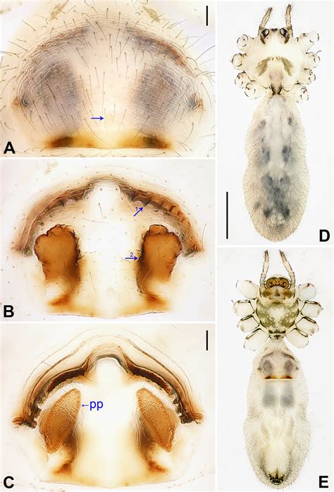 Pholcus Umphang Yao Li Sp Nov Paratype Female A Epigynum