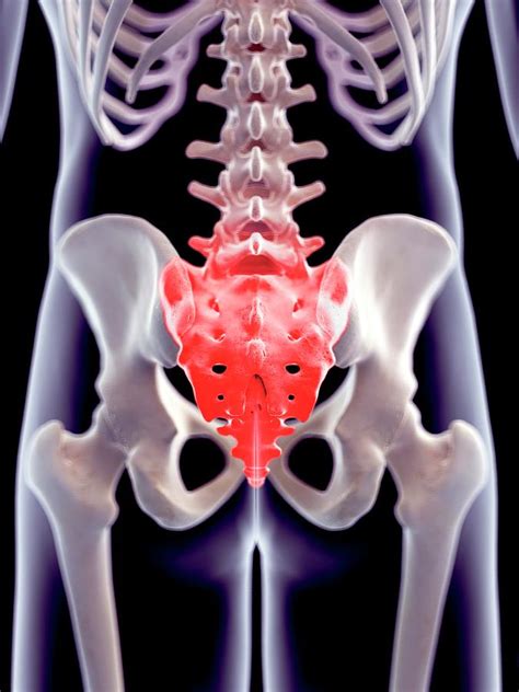 Human Sacrum Pain Photograph By Sebastian Kaulitzkiscience Photo