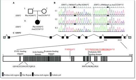 Whole Exome Sequencing Identified Compound Heterozygous Truncating