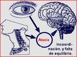 Ataxia cerebelosa congénita EcuRed