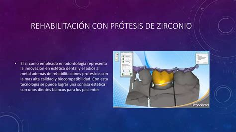 Prótesis de zirconio sobre implantes PPT