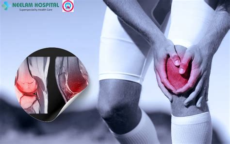 Get Best ACL Injury Operation in Punjab | Neelam Hospital