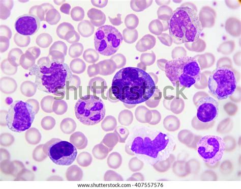 1,171 Peripheral Blood Smear Images, Stock Photos, 3D objects ...