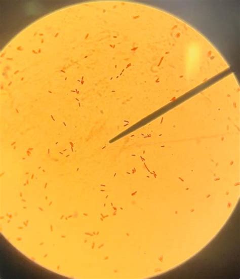 Solved UNKNOWN 2 Indicate Tube 1 Gram Staining Chegg