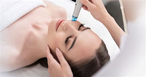 Microneedling Skin Treatment A Minimally Invasive Approach