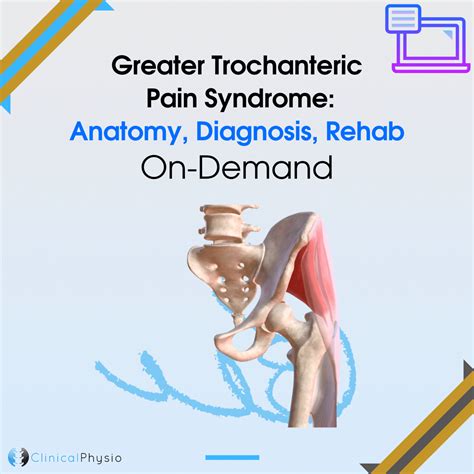 Greater Trochanteric Pain Syndrome On-Demand Webinar | Clinical Physio