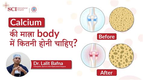 How Much Calcium Do We Need In A Day रोज कितना कैल्शियम लेना चाहिए Sci Hospital Youtube