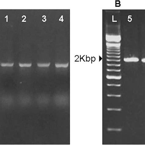 Agarose Gel Electrophoresis Of The Pcr Product Bp Of S Rna