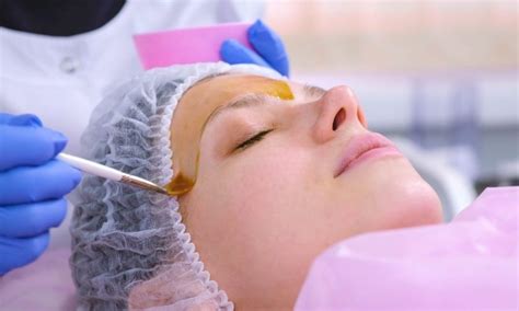 Which Is Better Chemical Peeling Or Laser Treatment